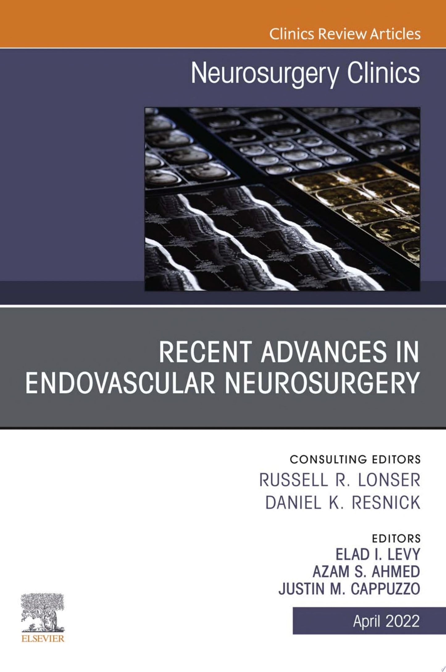 Recent Advances in Endovascular Neurosurgery, An Issue of Neurosurgery Clinics of North America, E-Book