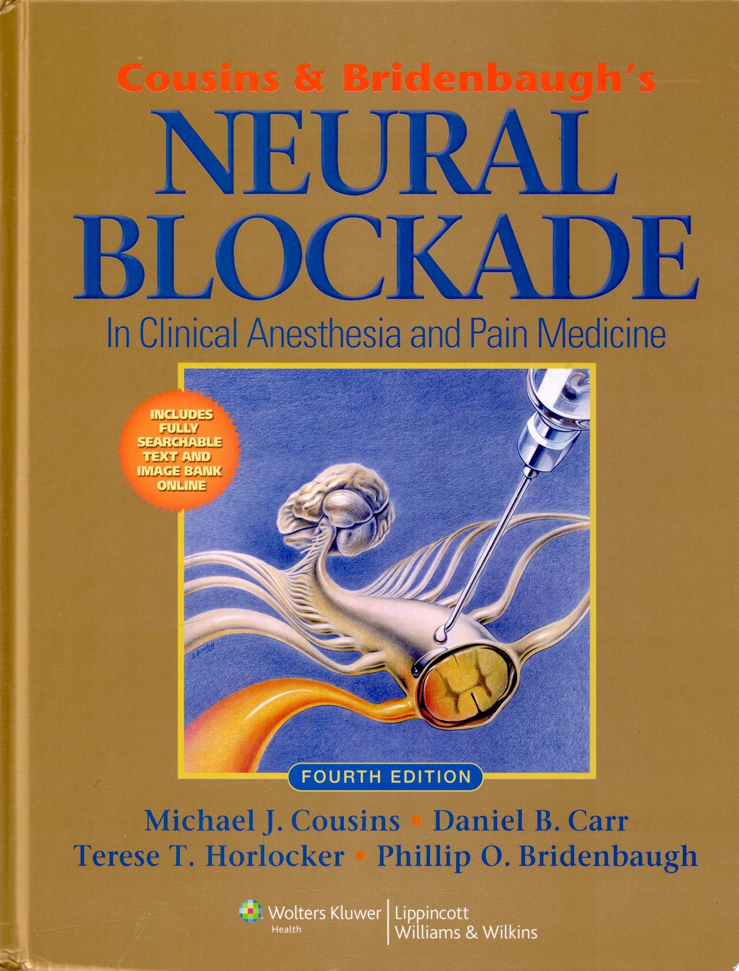 Pain Neurosurgery
