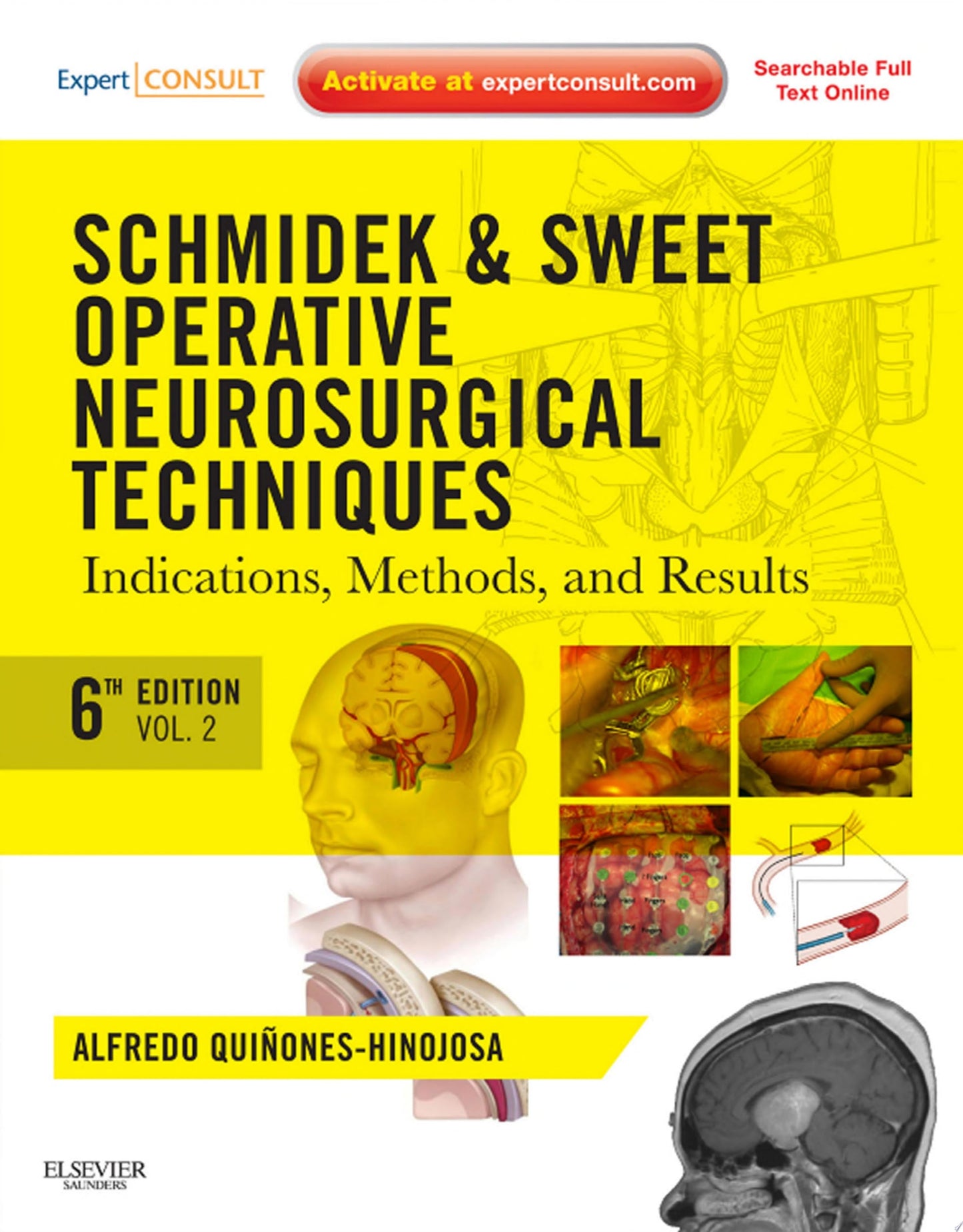 Schmidek and Sweet: Operative Neurosurgical Techniques 2-Volume Set: Indications, Methods and Results, 7th Edition