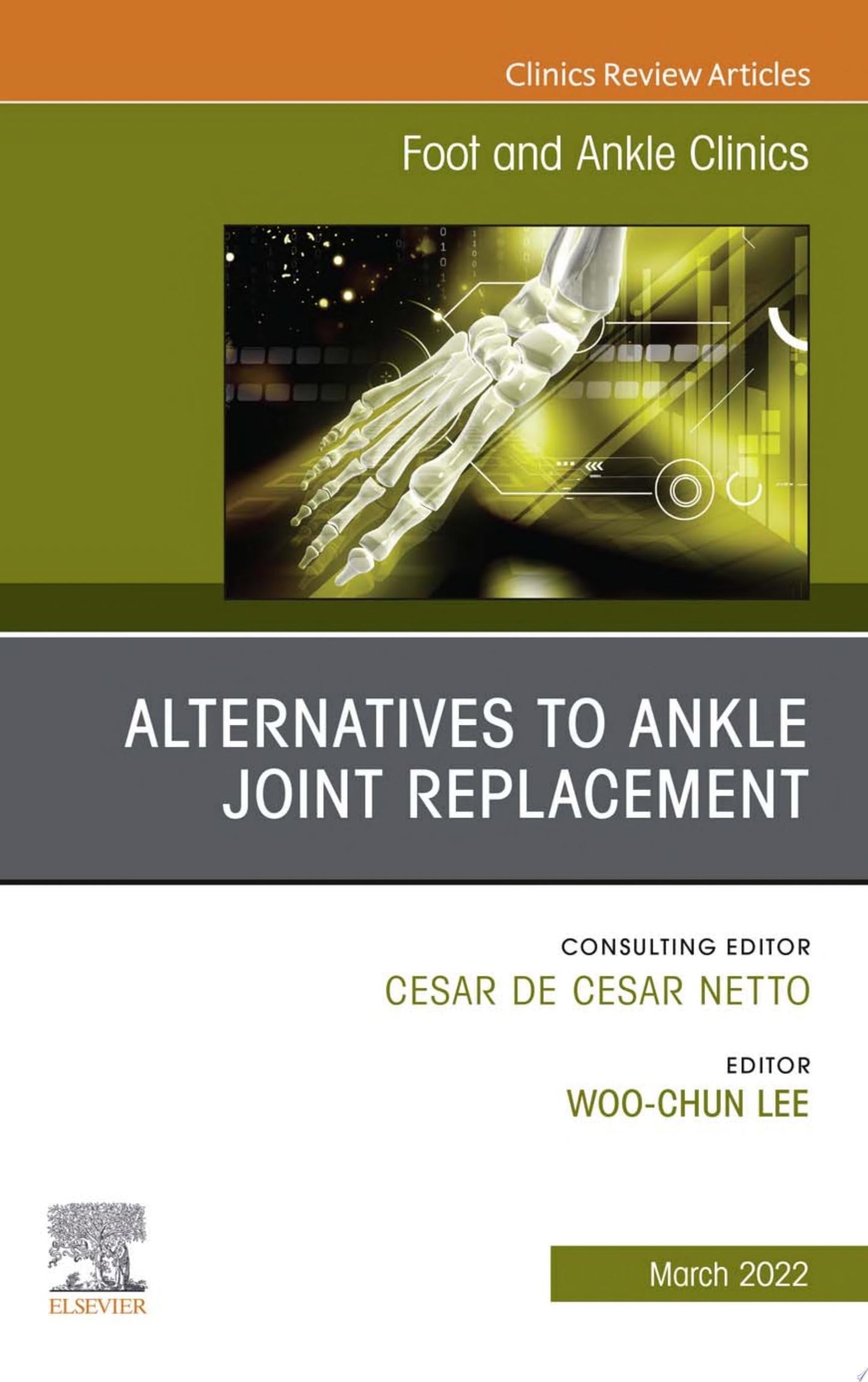 Joint Preserving Surgery of Ankle Osteoarthritis, an Issue of Foot and Ankle Clinics, 1e