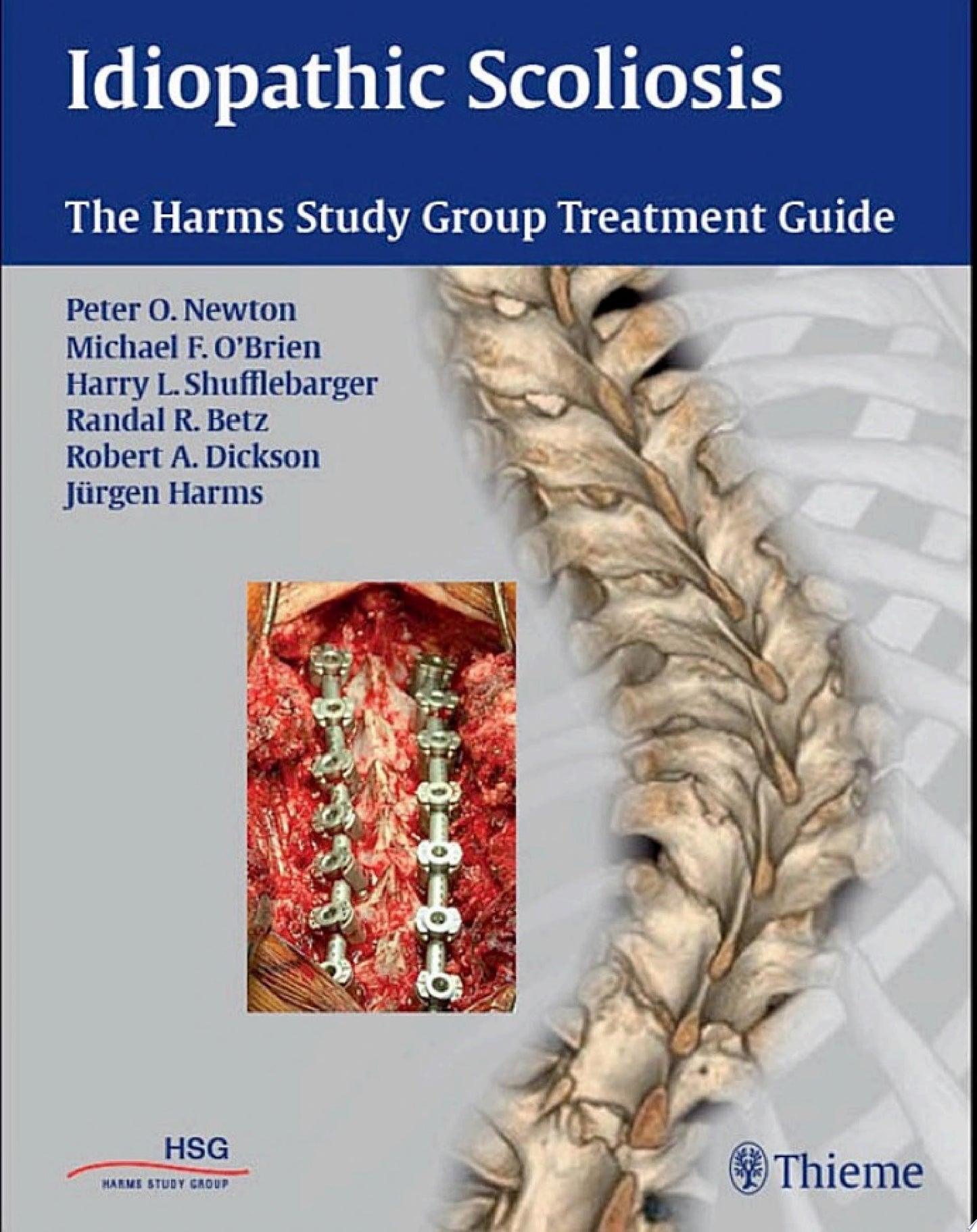 Idiopathic Scoliosis: The Harms Study Group Treatment Guide, 2nd edition