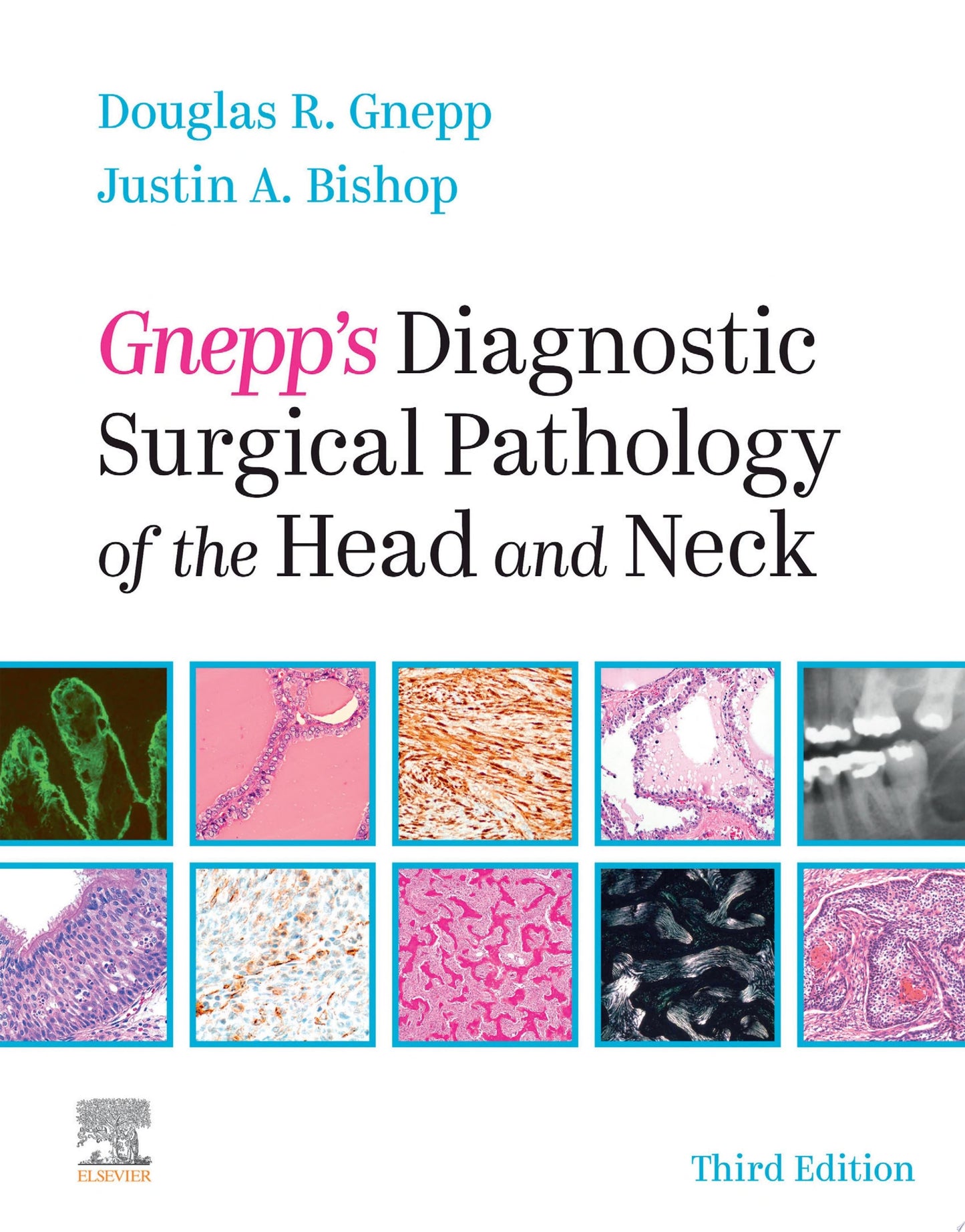 Gnepp's Diagnostic Surgical Pathology of the Head and Neck