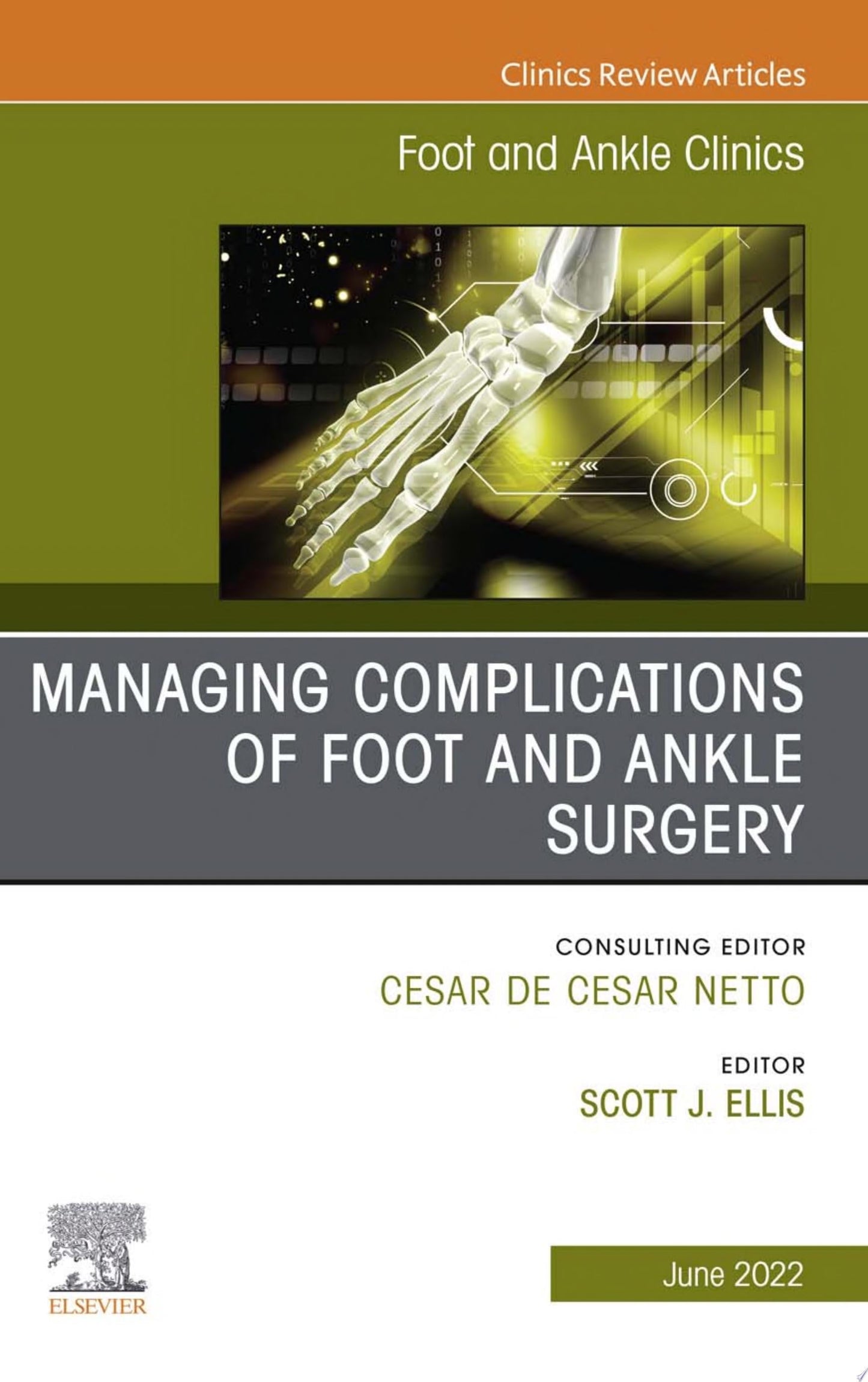 Varus Foot, Ankle, and Tibia, An Issue of Foot and Ankle Clinics, 1th edition