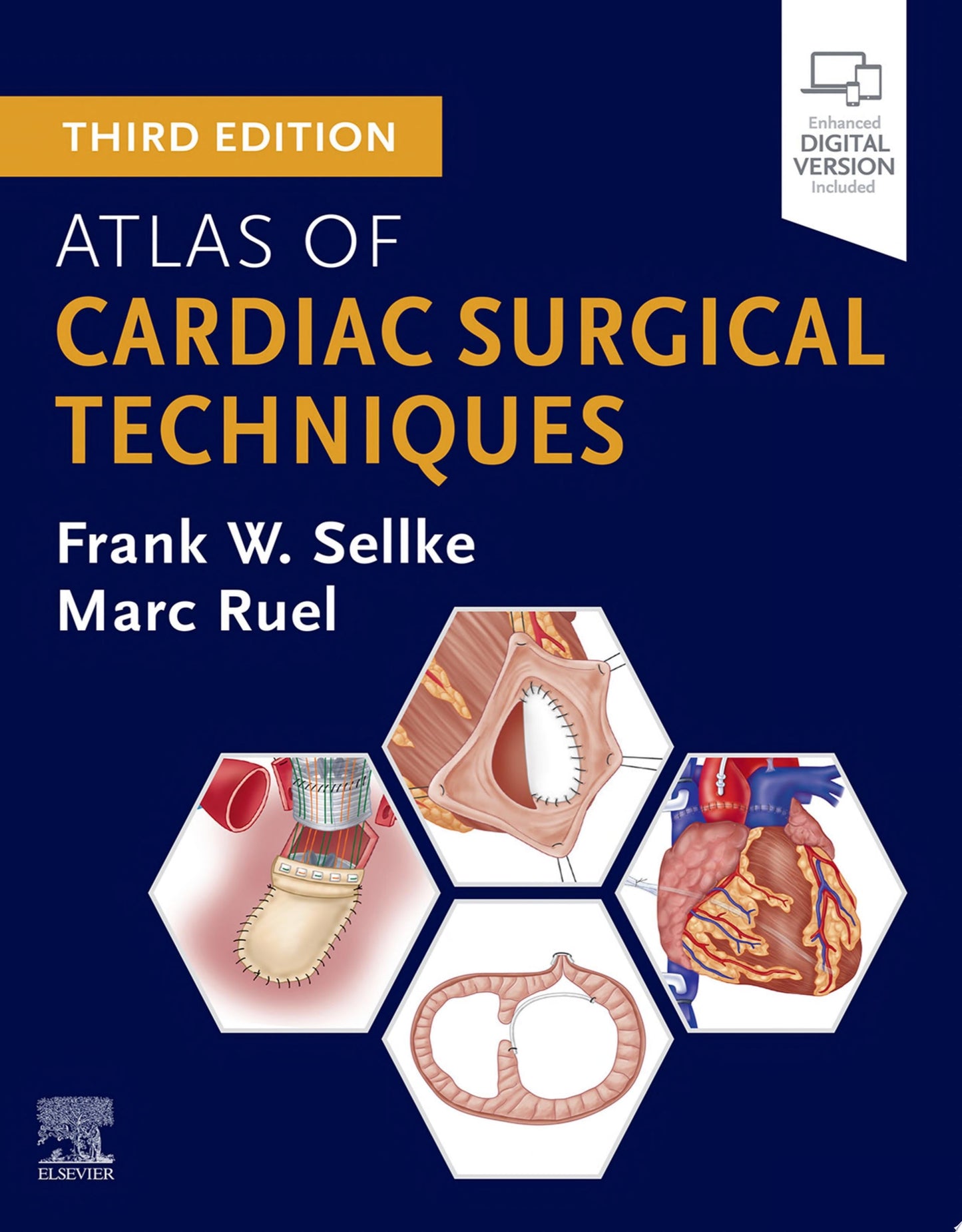 Atlas of Cardiac Surgical Techniques 3e (PDF + 33 Videos)