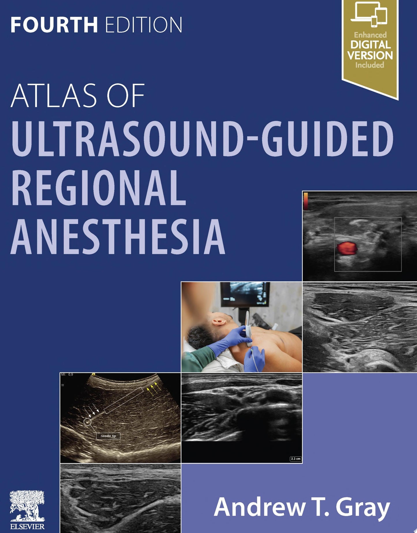 Atlas of Ultrasound-Guided Regional Anesthesia, 4th edition